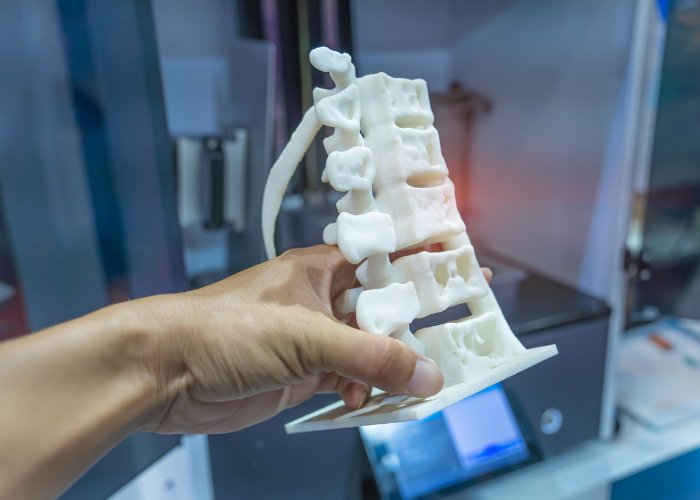 3D Printed Implants Spine Surgery Mumbai
