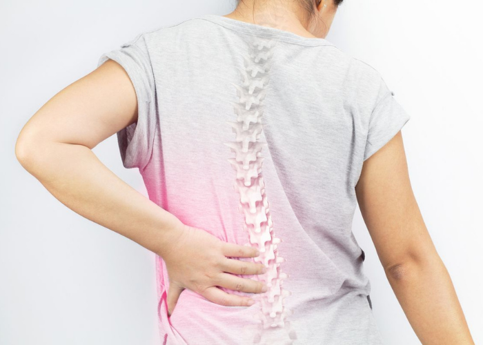 Adult Scoliosis
