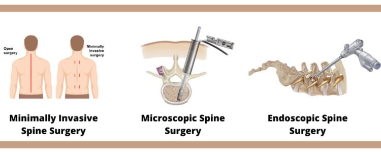 Minimally invasive spine surgery in Mumbai by Dr. Vishal Kundnani