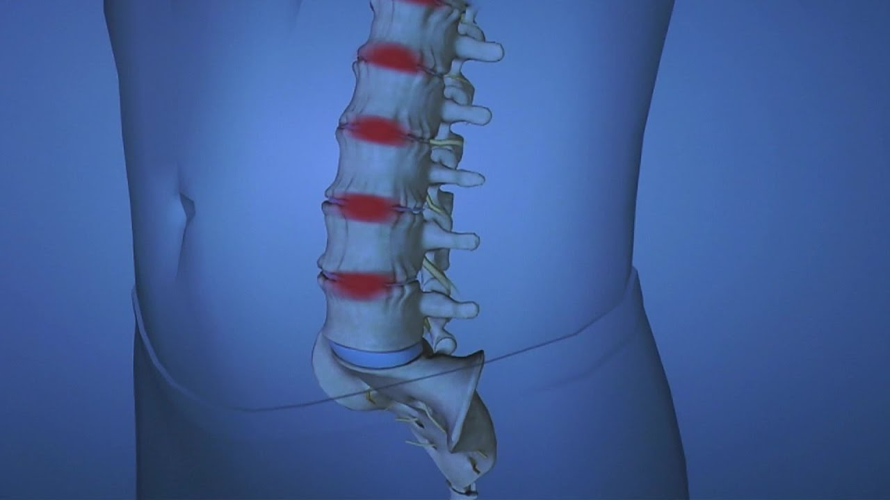 Daily Habits to Slow Down Spinal Degeneration