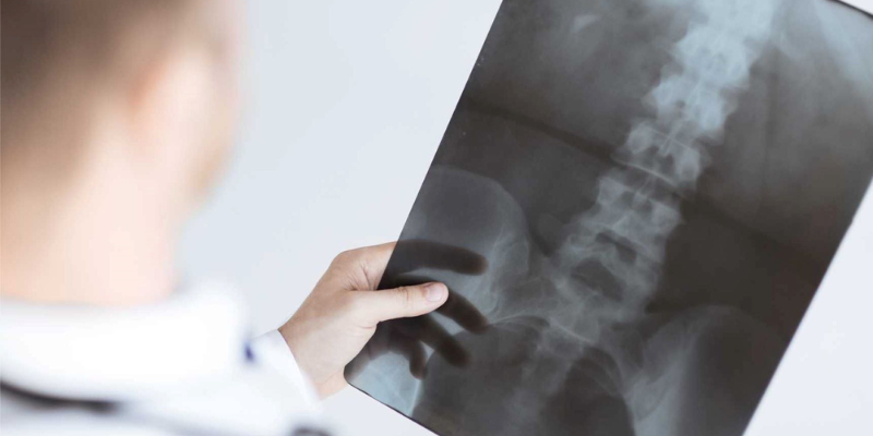 Best Spine Surgeon in Mumbai – How to Choose the Right Doctor